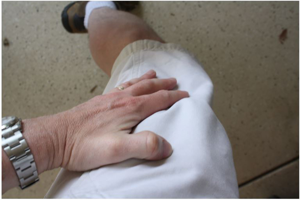 Hand massaging injection site